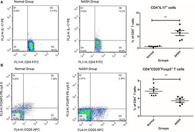 MicroRNA-29c Acting on FOS Plays a Significant Role in Nonalcoholic Steatohepatitis Through the Interleukin-17 Signaling Pathway